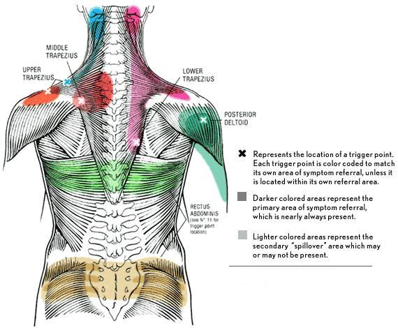 trigger_point_chart.jpg